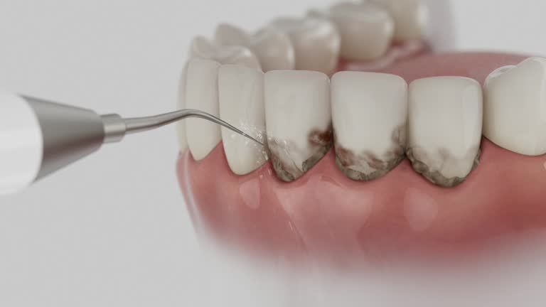 Trusted Tooth Extraction service in Wildwood, MO - Dentist Open Now